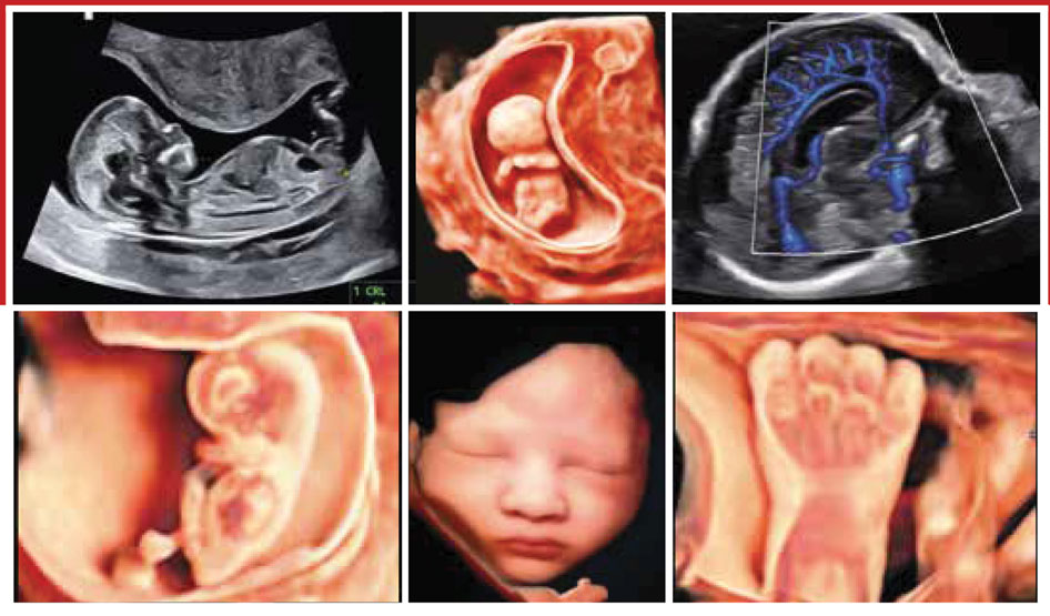Echo Anatomie Normale et Pathologique du FŒTUS